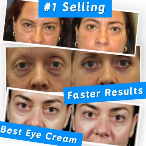Best 100%  Under Eye Cream - Remove Dark Circles Wrinkles Face Lines Puffy Eyes